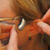 Hearing aids are now available over-the-counter in the United States
