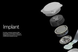 Neuralink