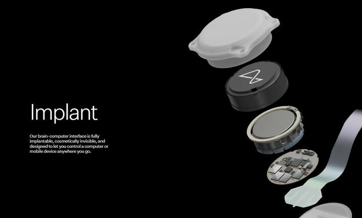 Neuralink