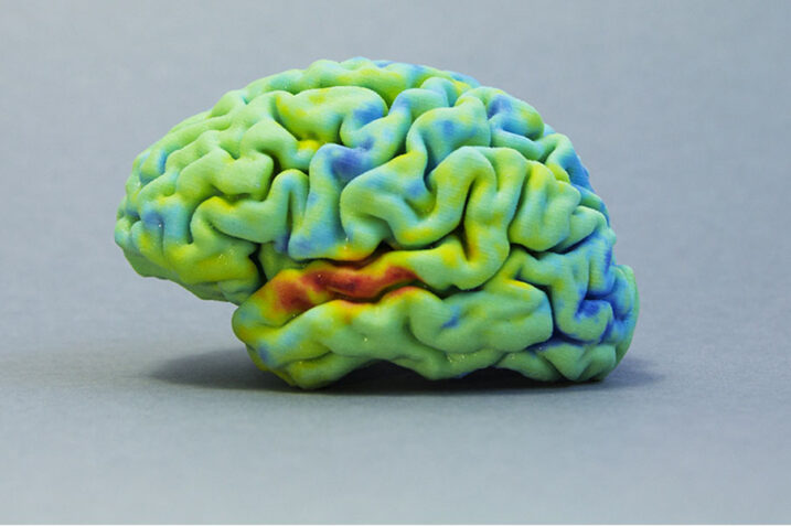 3D Printed Brain Tissue Shows Promise for Understanding Brain Function